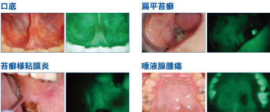 比較画像 白色灯とベルスコープVX
